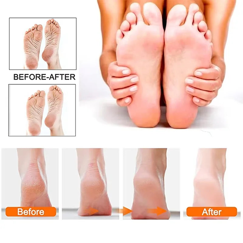 SmoothGlide Pro Foot File