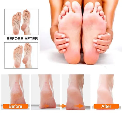 SmoothGlide Pro Foot File