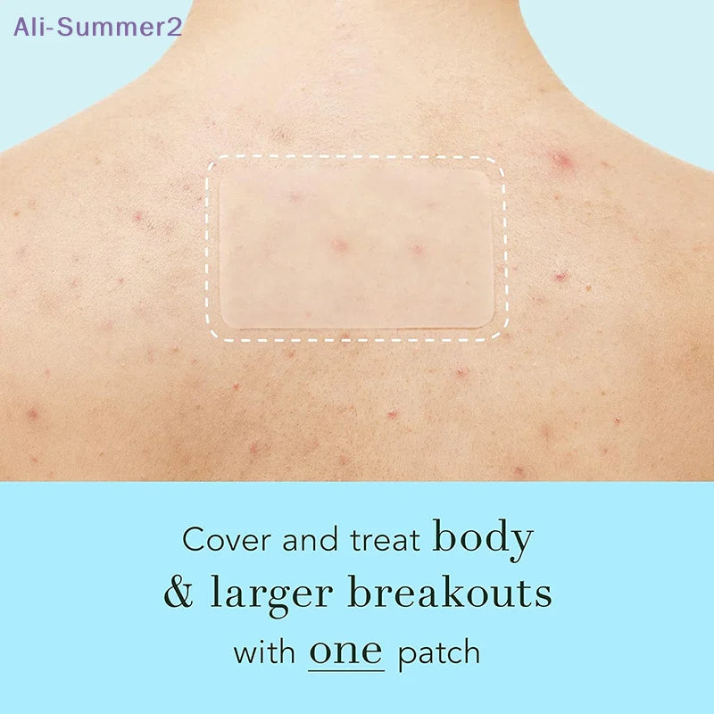 SkinShield XL – Hydrocolloid Skin Patches