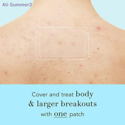 SkinShield XL – Hydrocolloid Skin Patches
